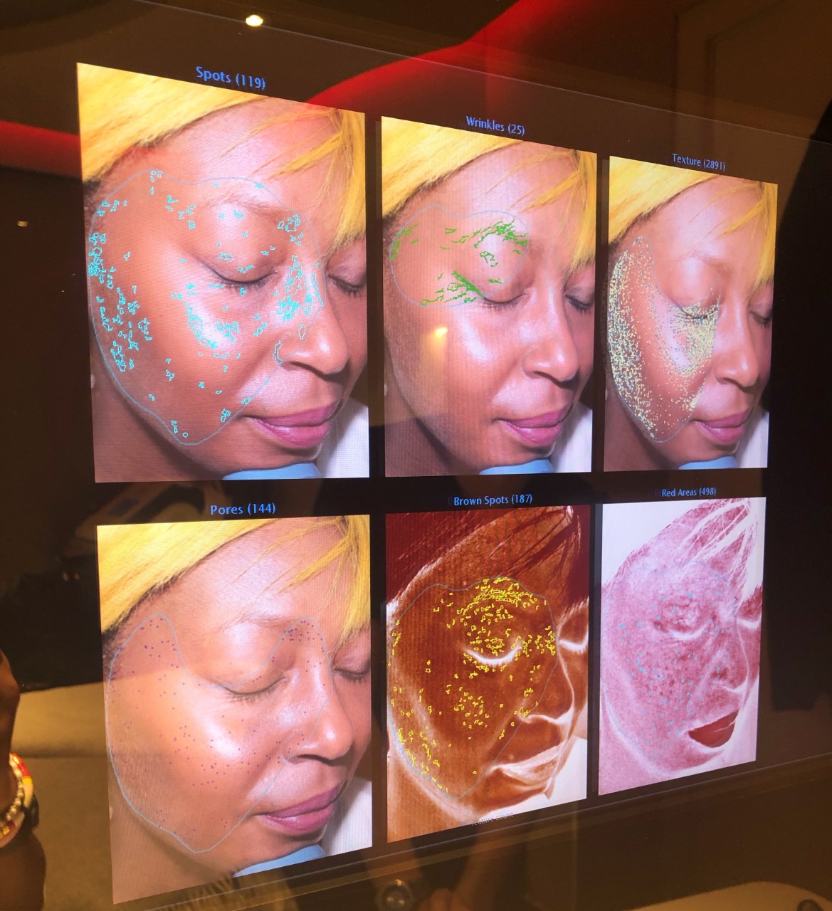 Top 92+ Pictures Elemis Biotec Facial